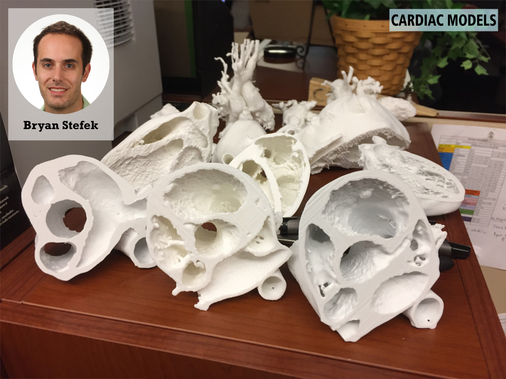 Bryan Stefek and his 3D cardiac models